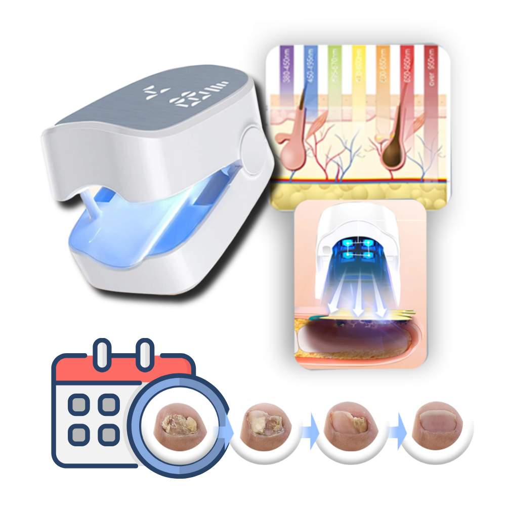 Dual Laser Nail Treatment Device with Blue Light and 7-Minute Auto Sessions