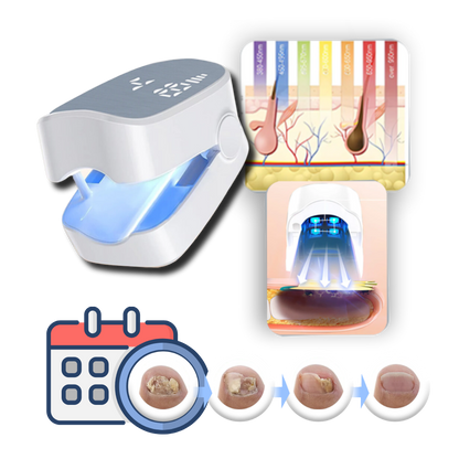 Dual Laser Nail Treatment Device with Blue Light and 7-Minute Auto Sessions