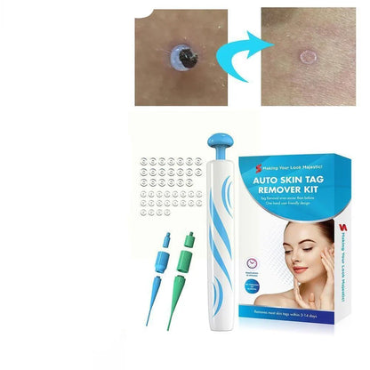 Skin Tag Removal Kit with Two Spring Sizes and 7-10 Day Process