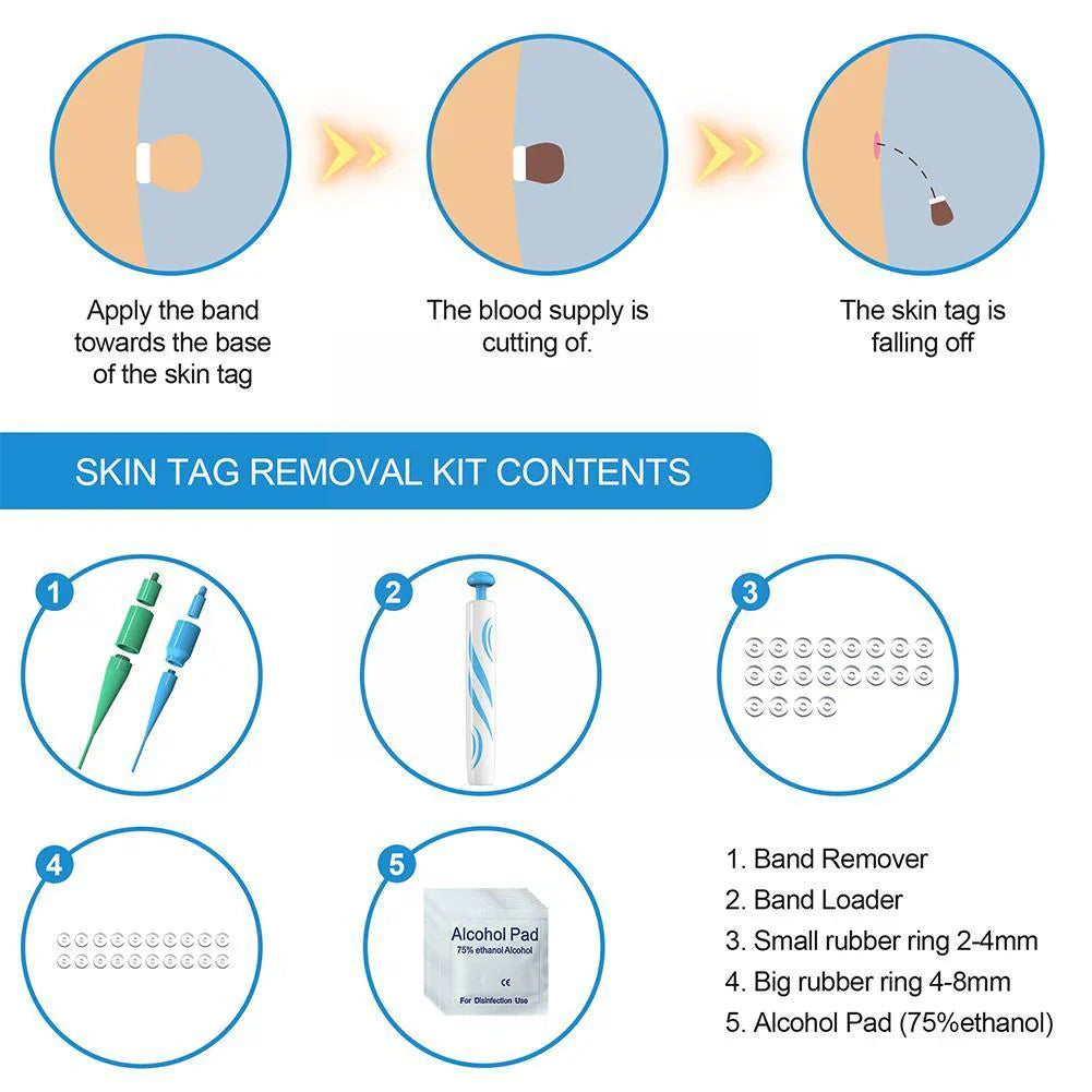 Skin Tag Removal Kit with Two Spring Sizes and 7-10 Day Process
