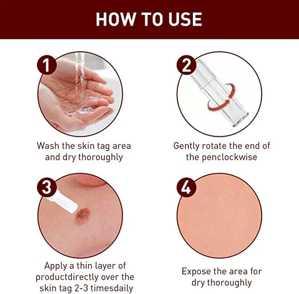 Topical Skin Tag Remover Solution with Tea Tree Oil and Arborvitae Extract