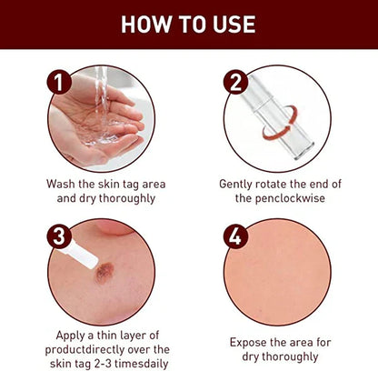 Topical Skin Tag Remover Solution with Tea Tree Oil and Arborvitae Extract