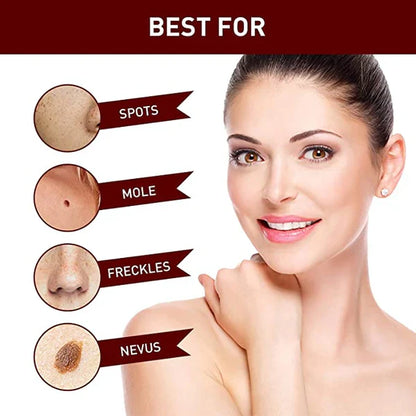 Topical Skin Tag Remover Solution with Tea Tree Oil and Arborvitae Extract