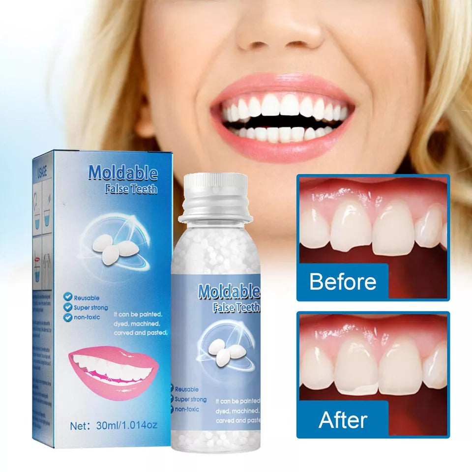 Moldable Tooth Repair Kit with Heat Activated Polymer Beads and Custom Molding