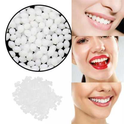 Moldable Tooth Repair Kit with Heat Activated Polymer Beads and Custom Molding